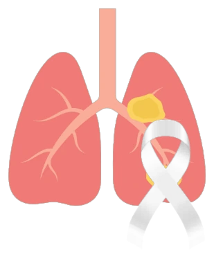 Lung cancer awareness illustration